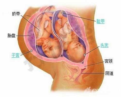 深圳哪里有代怀,孕期，孕妈这几个动作会特别容