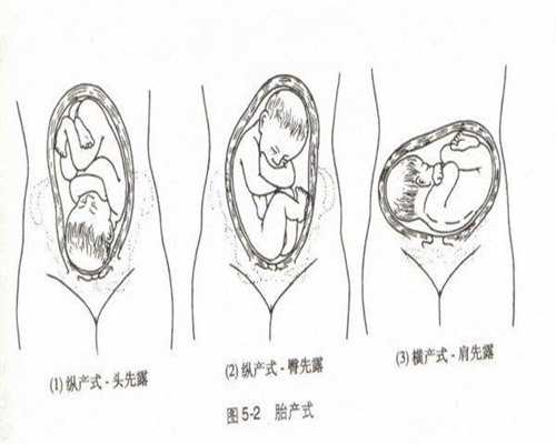 深圳最好的代怀机构,孕期如何做到“长胎不长肉