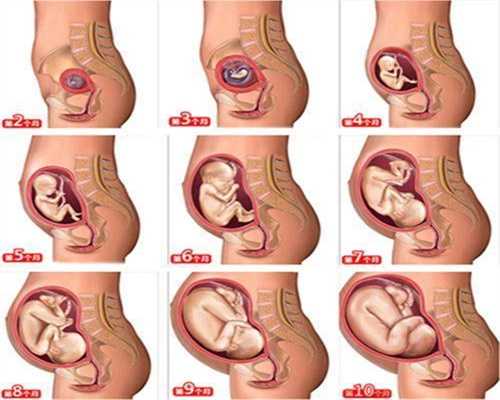 怀孕期间有两个时间点，孕妇需要注意，而且非