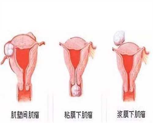 深圳代孕中心_代孕服务公司_最诚信的代孕公司