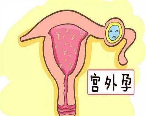 深圳代孕包成功_想找代孕工作_代怀孕条件