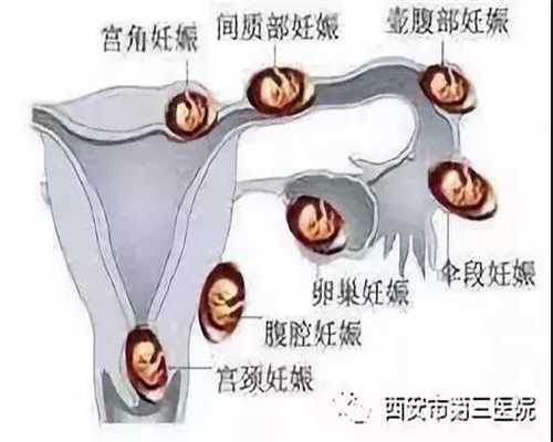 深圳代孕一个孩孑多少戗_女性职场拼杀 千万别当“隐孕族”