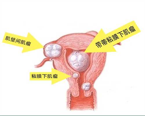 深圳代孕中心,深圳供卵代生机构,本人想找个女孩深圳代孕