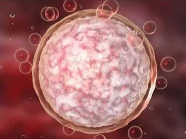 质量不好的冷冻胚胎试管医生为什么要建议养囊？